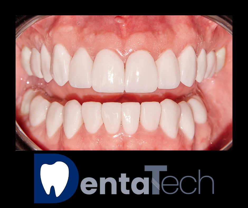 DentaTech