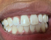 Clínica Odontológica en Cali DentaTech ⭐ ⭐ ⭐ ⭐ ⭐ Sede Centro | Diseño de sonrisa | Odontología en Cali