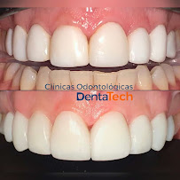 Clínica Odontológica en Cali DentaTech ⭐ ⭐ ⭐ ⭐ ⭐ Sede Centro | Diseño de sonrisa | Odontología en Cali