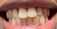 Clínica Odontológica en Cali DentaTech ⭐ ⭐ ⭐ ⭐ ⭐ Sede Centro | Diseño de sonrisa | Odontología en Cali