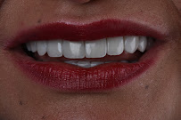 DRA. SANDRA GARCÍA - REJUVENECIMIENTO DENTAL ®️ - Rehabilitación Biomimética - Diseño de Sonrisa - Implantología