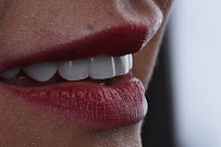 DRA. SANDRA GARCÍA - REJUVENECIMIENTO DENTAL ®️ - Rehabilitación Biomimética - Diseño de Sonrisa - Implantología