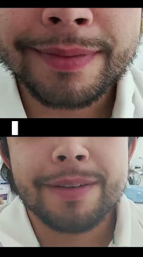 DRA. SANDRA GARCÍA - REJUVENECIMIENTO DENTAL ®️ - Rehabilitación Biomimética - Diseño de Sonrisa - Implantología