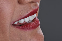 DRA. SANDRA GARCÍA - REJUVENECIMIENTO DENTAL ®️ - Rehabilitación Biomimética - Diseño de Sonrisa - Implantología