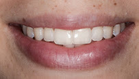 Dental Innovation