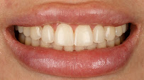 Dental Innovation