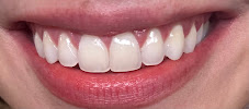 Dental Innovation