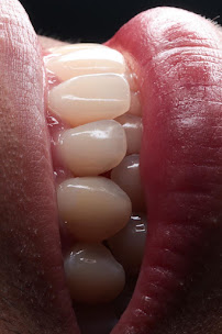 Dental Innovation