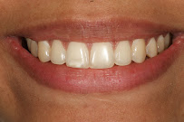 Dental Innovation