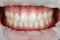 Dental Innovation
