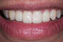 Dental Innovation