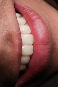 Dental Innovation