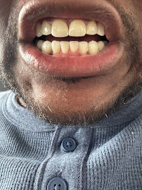 Doctora Sara Zapata - Estética Dental - Porcelain Veneers - Diseños De Sonrisa - Odontología