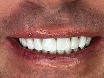 Dra. Paola Chicue | Cosmetic Dentist & Veneers in Cali