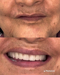 Dra. Paola Chicue | Cosmetic Dentist & Veneers in Cali