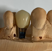 Dra. Paola Chicue | Cosmetic Dentist & Veneers in Cali