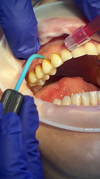 Dra. Paola Chicue | Cosmetic Dentist & Veneers in Cali