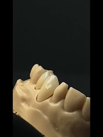 Dra. Paola Chicue | Cosmetic Dentist & Veneers in Cali
