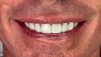 Dra. Paola Chicue | Cosmetic Dentist & Veneers in Cali