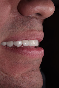 Dra. Paola Chicue | Cosmetic Dentist & Veneers in Cali