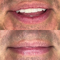 Dra. Paola Chicue | Cosmetic Dentist & Veneers in Cali