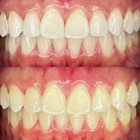 Dra. Paola Chicue | Cosmetic Dentist & Veneers in Cali