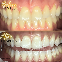 Dra. Paola Chicue | Cosmetic Dentist & Veneers in Cali