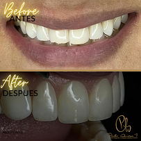 Dra. Paola Chicue | Cosmetic Dentist & Veneers in Cali