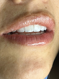 Dra. Paola Chicue | Cosmetic Dentist & Veneers in Cali