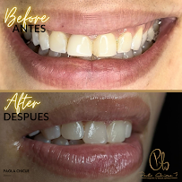 Dra. Paola Chicue | Cosmetic Dentist & Veneers in Cali
