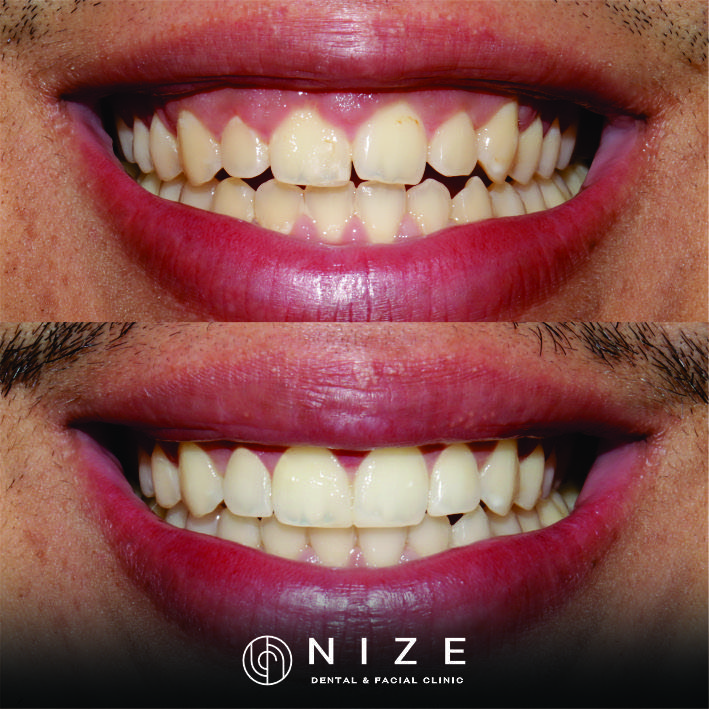 Nize Dental & Facial