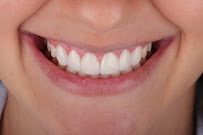 Nize Dental & Facial - Clínica Facial y Odontológica en Cali