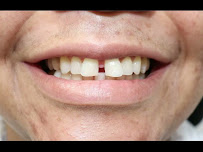 Nize Dental & Facial - Clínica Facial y Odontológica en Cali