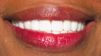 Clínica Santa Luciana - Ronquistop