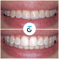 Clinica Dental Tascón Odontología e Implantes Dentales en Cali