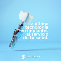 Clinica Dental Tascón Odontología e Implantes Dentales en Cali