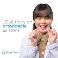 Clinica Dental Tascón Odontología e Implantes Dentales en Cali