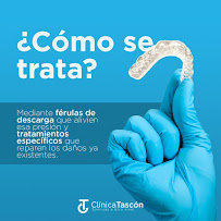 Clinica Dental Tascón Odontología e Implantes Dentales en Cali