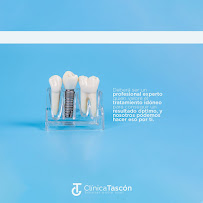 Clinica Dental Tascón Odontología e Implantes Dentales en Cali
