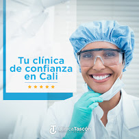 Clinica Dental Tascón Odontología e Implantes Dentales en Cali