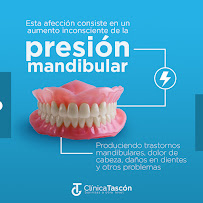 Clinica Dental Tascón Odontología e Implantes Dentales en Cali