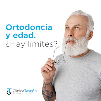 Clinica Dental Tascón Odontología e Implantes Dentales en Cali