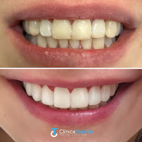 Clinica Dental Tascón Odontología e Implantes Dentales en Cali