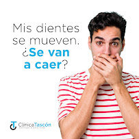 Clinica Dental Tascón Odontología e Implantes Dentales en Cali
