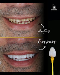 INGENIERÍA DE SONRISAS | SMILE DESIGN