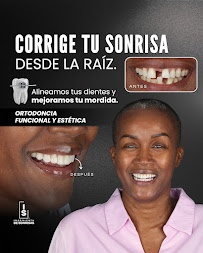 INGENIERÍA DE SONRISAS | SMILE DESIGN