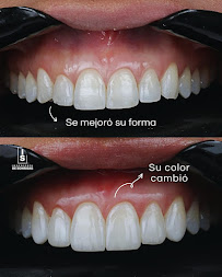 INGENIERÍA DE SONRISAS | SMILE DESIGN