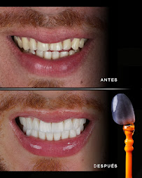 INGENIERÍA DE SONRISAS | SMILE DESIGN