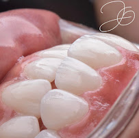 Dra Jen Ospina Estética Dental - Porcelain Veneers