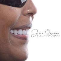Dra Jen Ospina Estética Dental - Porcelain Veneers